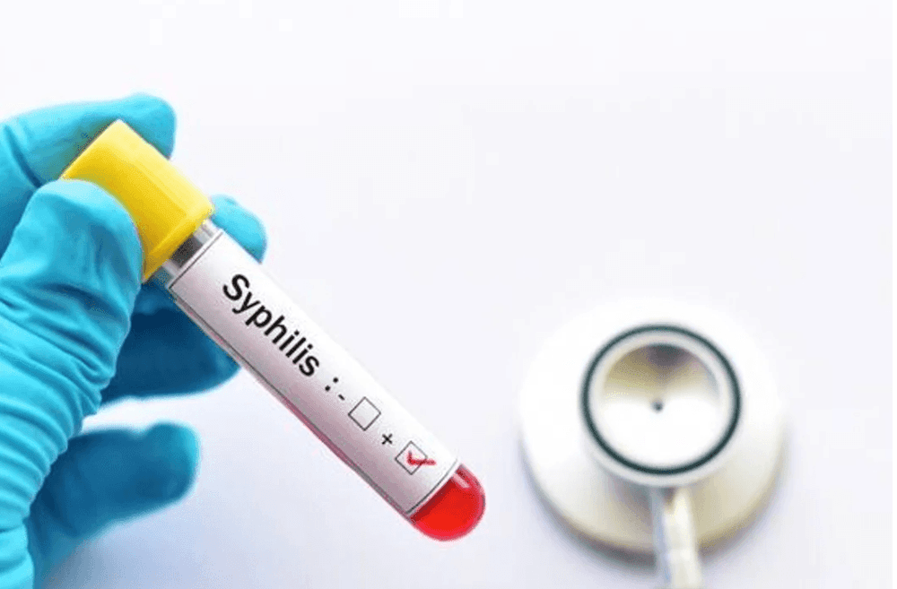 Alerta sífilis: los casos se incrementaron un 20,5% en Argentina